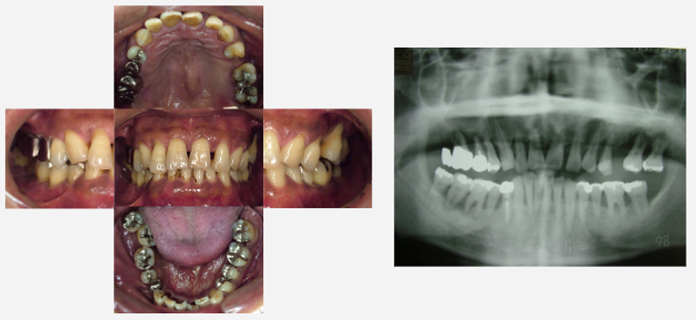 2008年03月　初診時