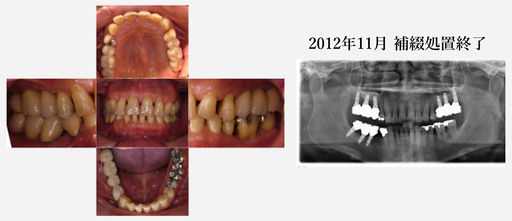 2016年6月　約4年経過