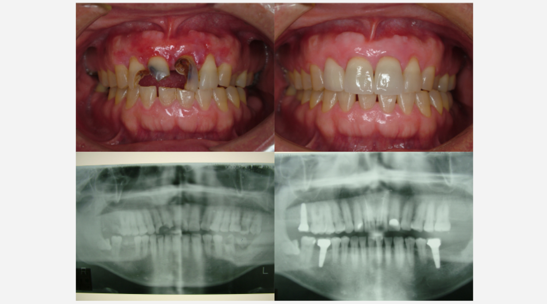 治療前と治療後